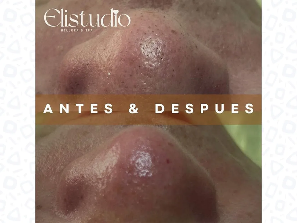 ELISTUDIO-2